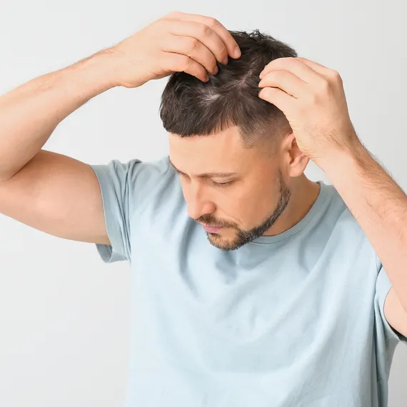 Man checking his hairline in a mirror